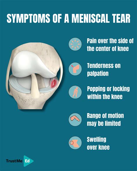 7 test for meniscus tear|self test meniscus tear.